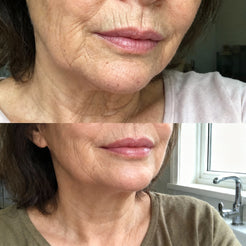 Protiráskový vápníkový balzám