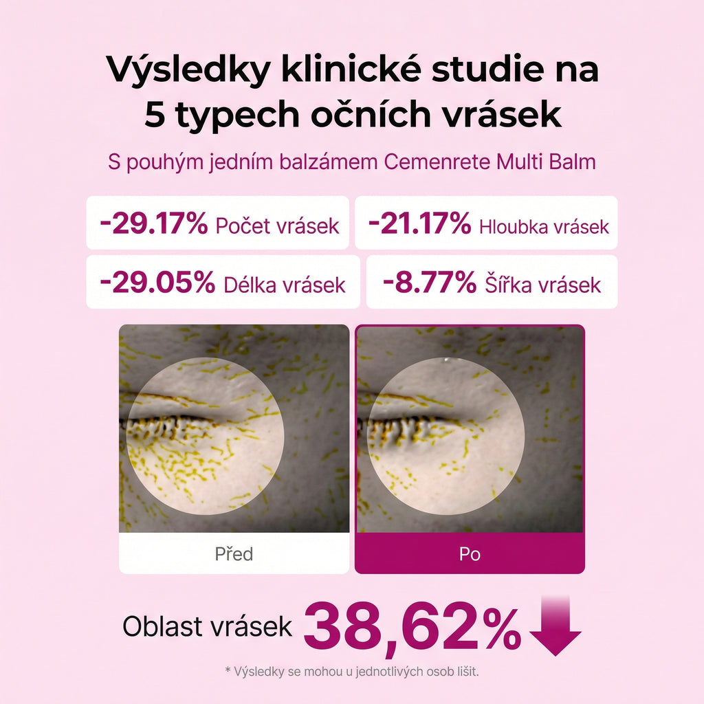 Protiráskový vápníkový balzám